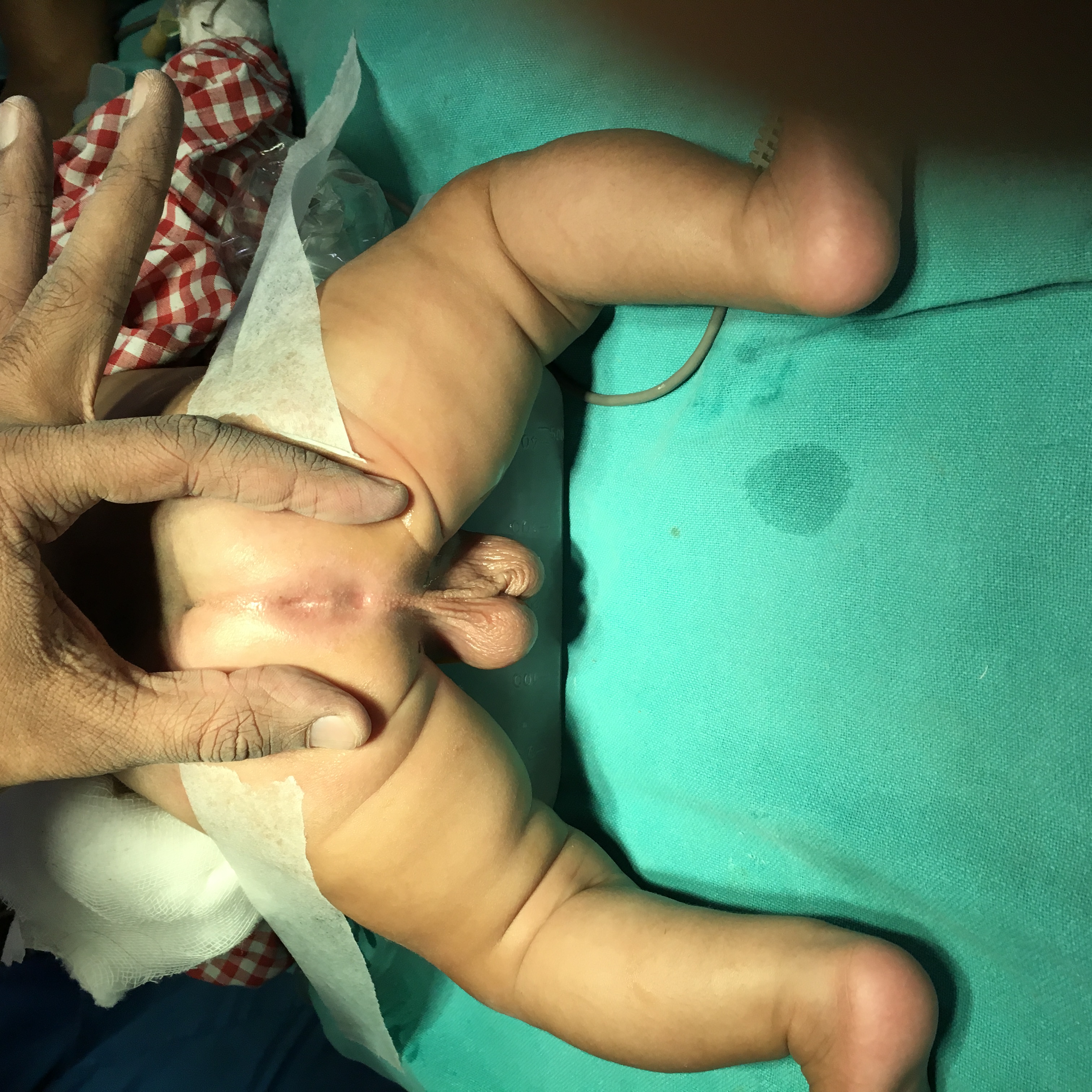Pediatric G.I. Surgery Image 6